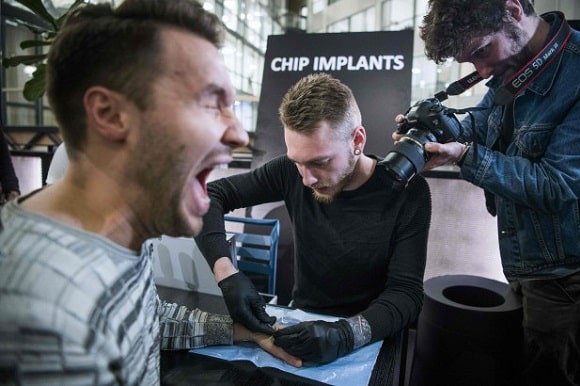 Chip Implants